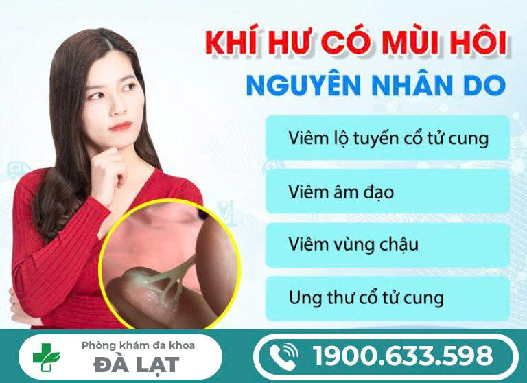 Hình ảnh minh họa